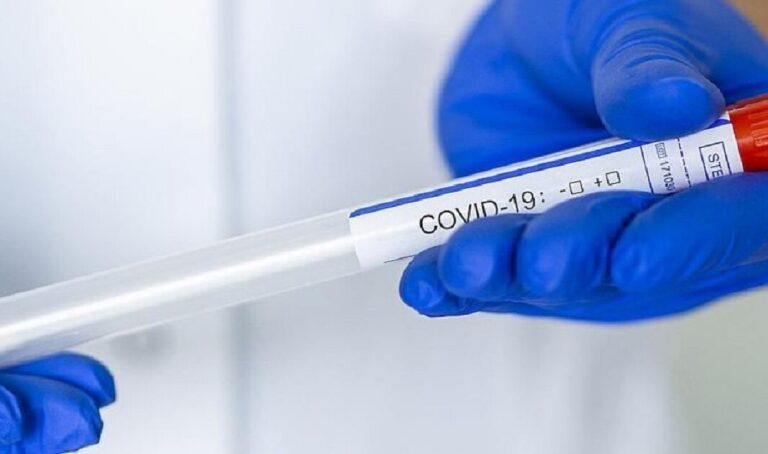 PCR-testirovanie